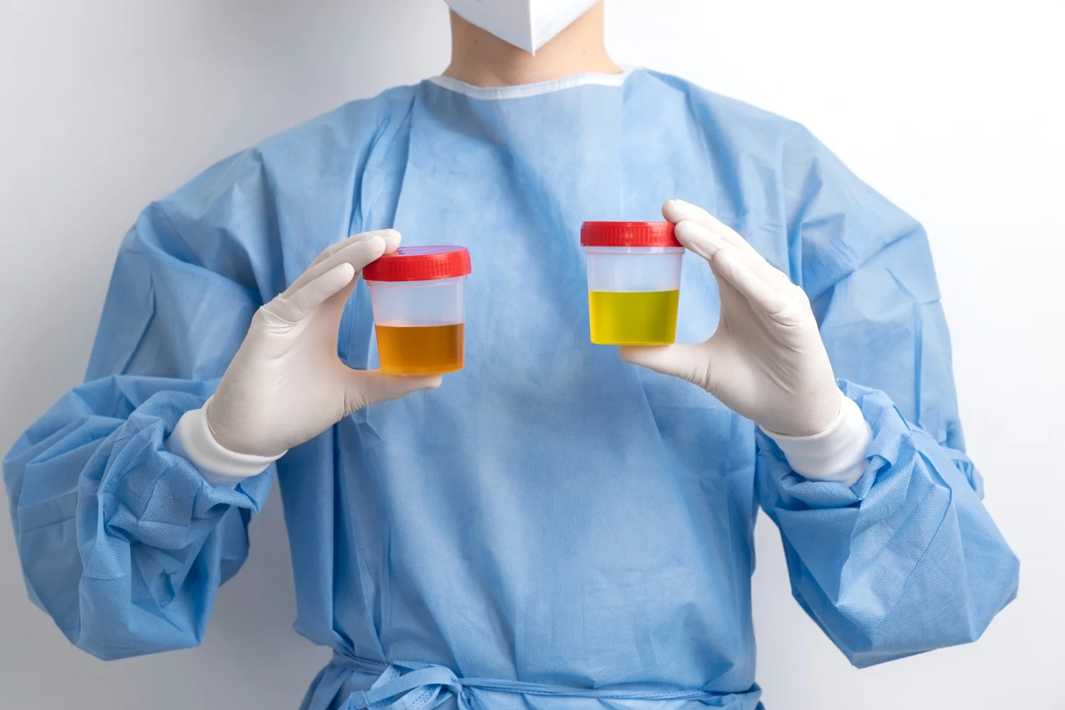 24 Hours Urine Protein Clearance