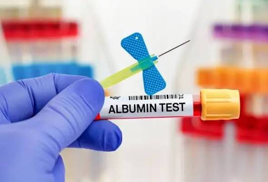 Serum Albumin