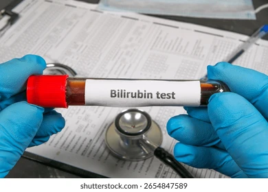 Bilirubin (Conjugated & Total)