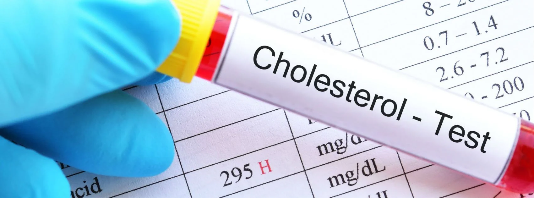 Total Cholesterol