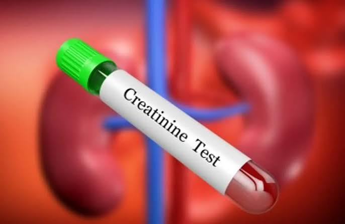 Creatinine