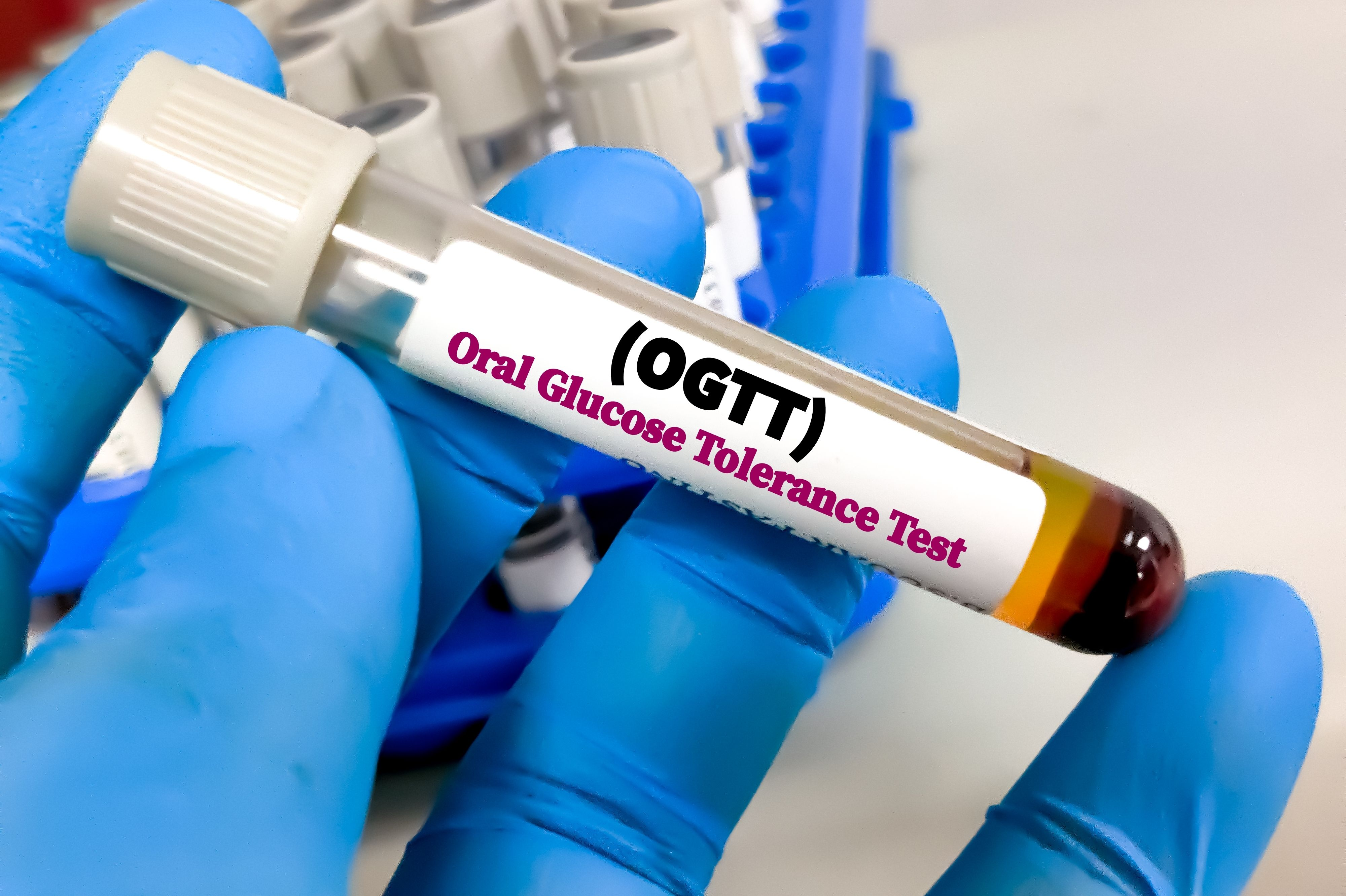 OGTT (Oral Glucose Tolerance Test)