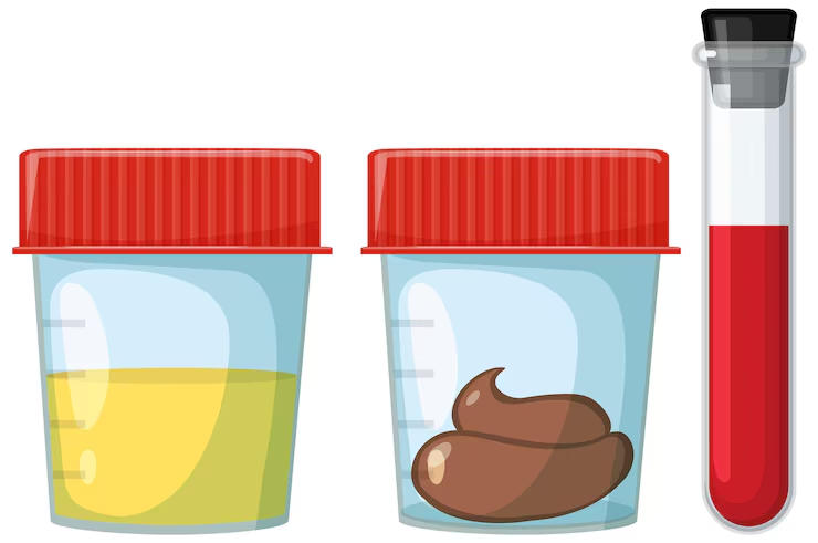 Occult Blood (Stool & Urine)