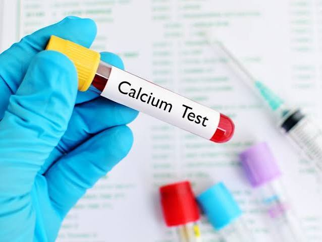Serum Calcium