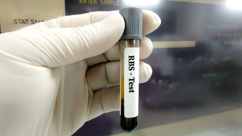 Blood Glucose (FBS/RBS)