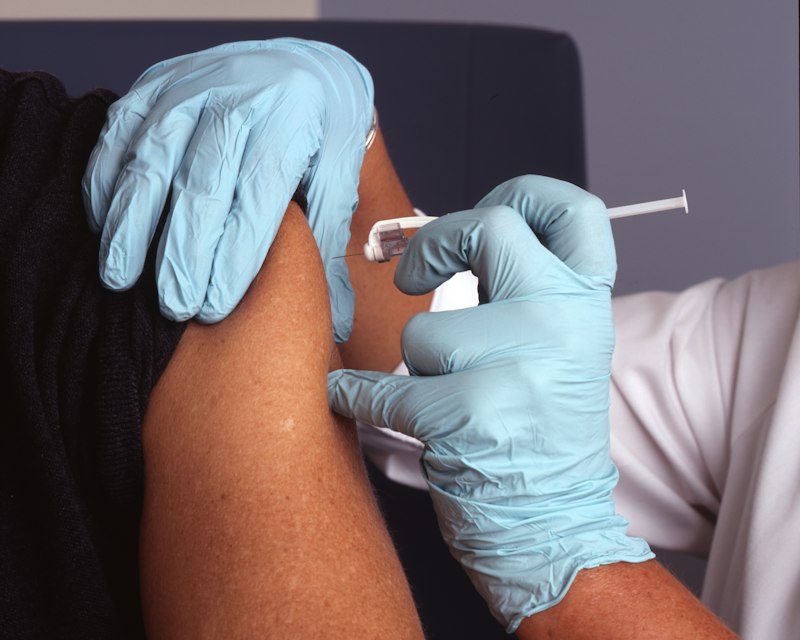 Retroviral Screening (HIV)