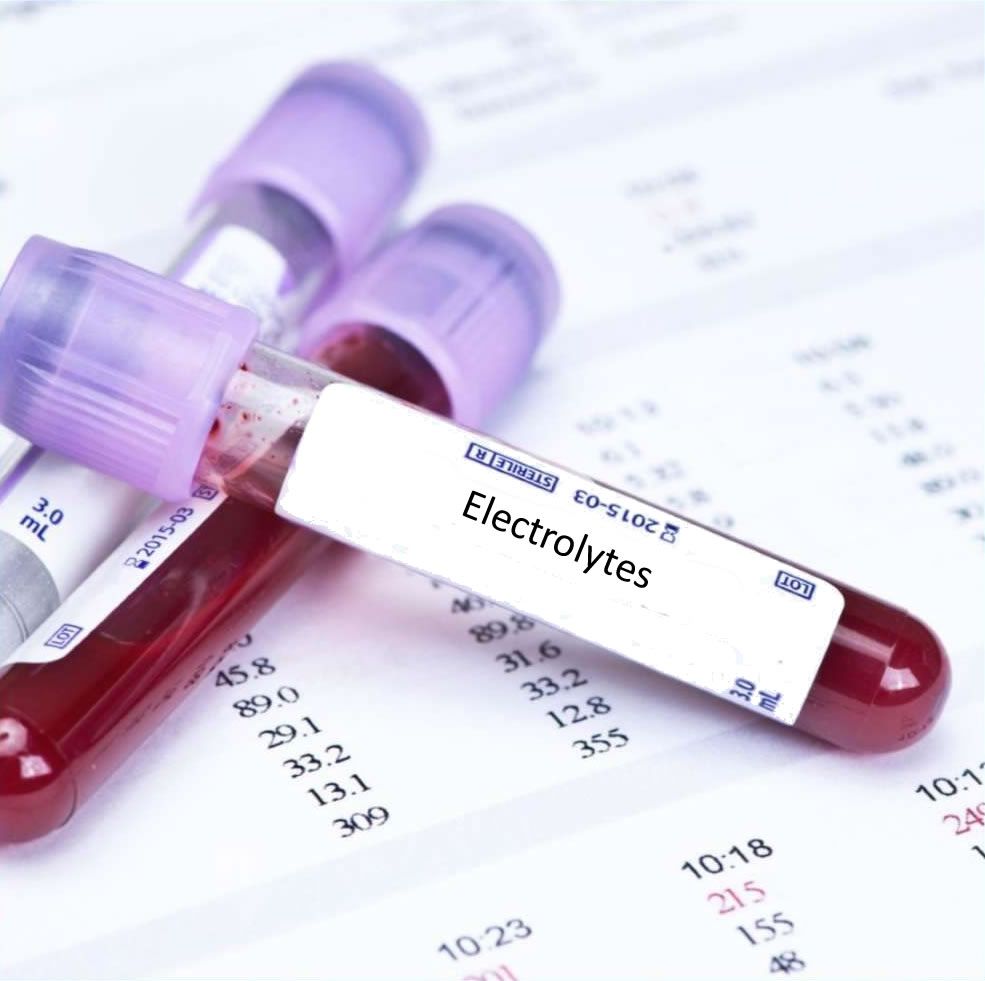 Serum Electrolyte