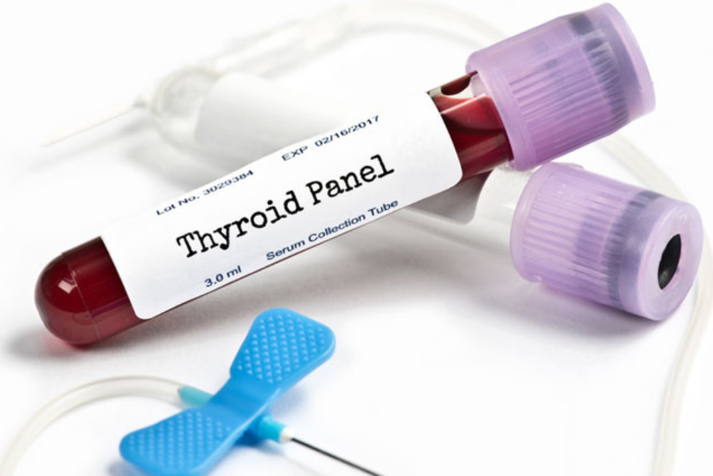 Thyroid Function Test (T3, T4, TSH)