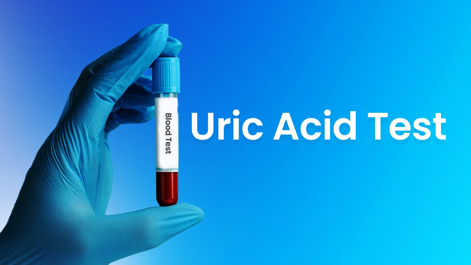 Uric Acid Test